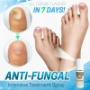 Anti-Fungal Treatment Spray