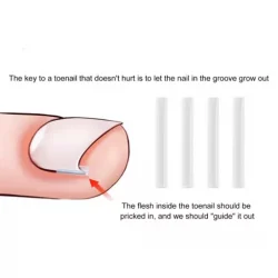 Ingrown Toenail Correction Tool