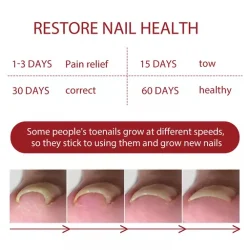 Anti Paronychia Relief Oil Ingrown Toenail Drops