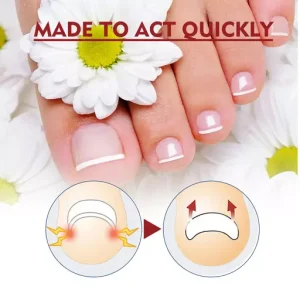 Anti Paronychia Relief Oil Ingrown Toenail Drops