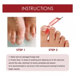 Anti Paronychia Relief Oil Ingrown Toenail Drops