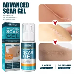 Advanced Scar Removal Gel