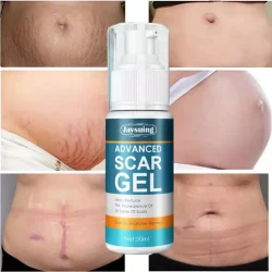 Advanced Scar Removal Gel