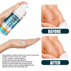 Advanced Scar Removal Gel