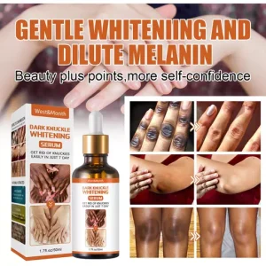 Dark Knuckles Whitening Serum