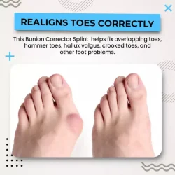 Bunion Corrector Splint Big Toe Straightener