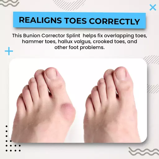 Bunion Corrector Splint Big Toe Straightener