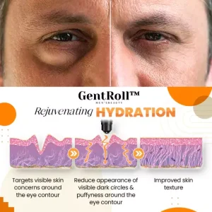 GentRoll Hyaluronic Acid Eye Roller