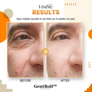 GentRoll Hyaluronic Acid Eye Roller