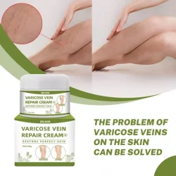 Varicose Vein Repair Cream