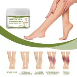 Varicose Vein Repair Cream