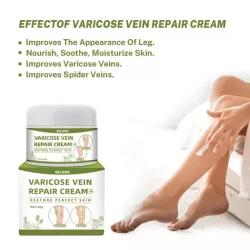 Varicose Vein Repair Cream