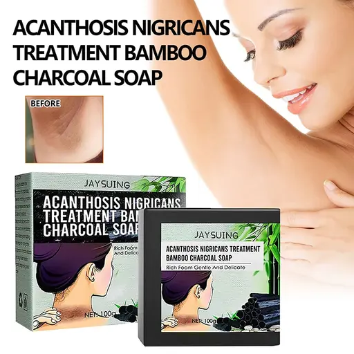 flysmus Acanthosis Nigricans Treatment Bamboo Charcoal Soap