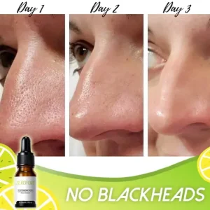Belay Always Young Lactobionic Acid Zero Pore Instant Perfection Serum