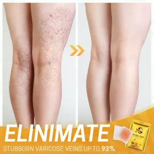 Spider Legs Herbal Healing Patch