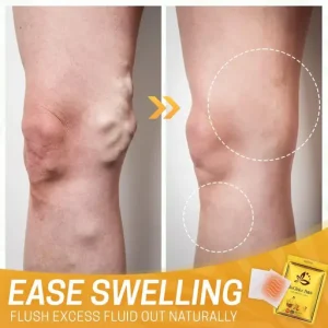 Spider Legs Herbal Healing Patch
