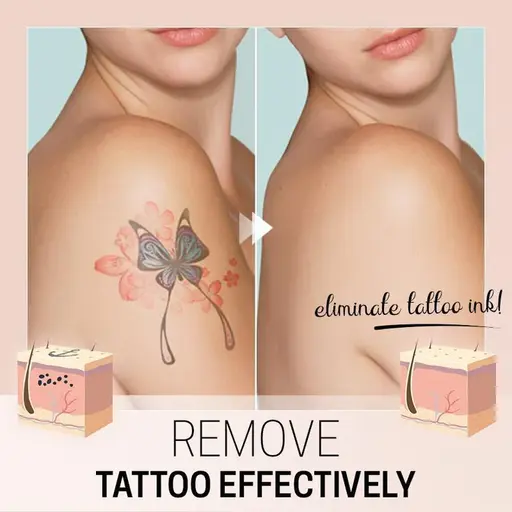 Tat Eraser Permanent Tattoo Removal Cream