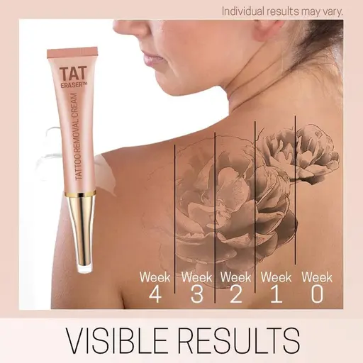 Tat Eraser Permanent Tattoo Removal Cream