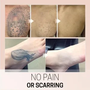 Tat Eraser Permanent Tattoo Removal Cream