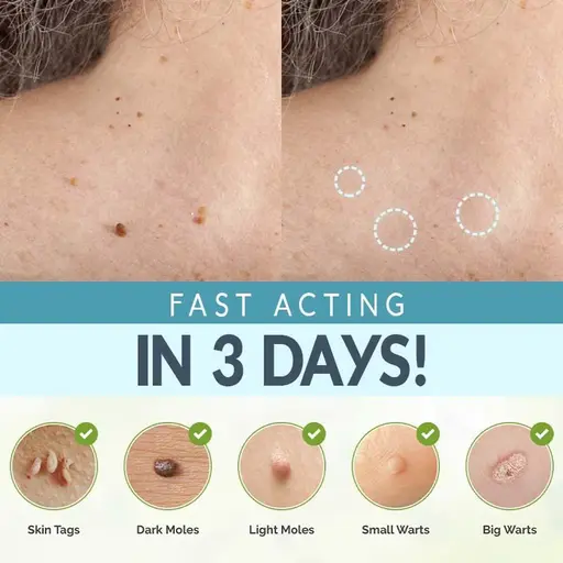 Skin Tag Remover Patches