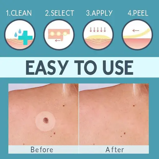 Skin Tag Remover Patches