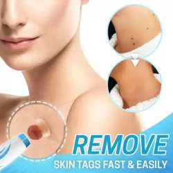Auto Tag Fast Removal Kit