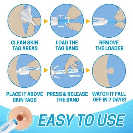 Auto Tag Fast Removal Kit