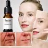 Instant Perfection Wrinkles Essence Serum