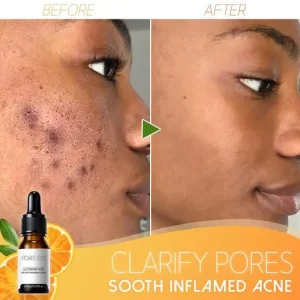 Poreless Instant Minimizing Serum
