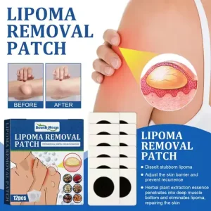 South Moon Lipoma Removal Patch
