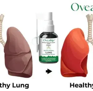 Oveallgo Detox Herbal Lung Cleansing Spray