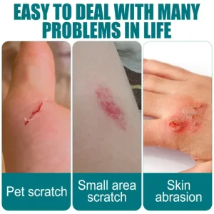 South Moon Gel Bandage Plaster
