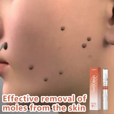 GFOUK™ WipeOff Tags and Moles Eliminator