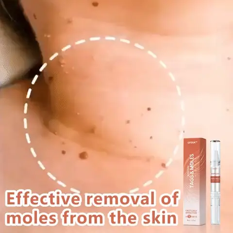 GFOUK™ WipeOff Tags and Moles Eliminator