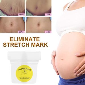 Anti-Stretch Marks Turmeric Fading Cream