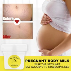 Anti-Stretch Marks Turmeric Fading Cream