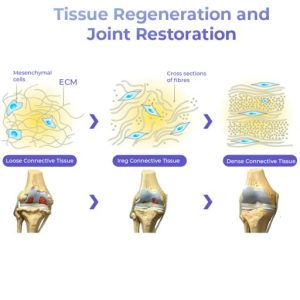 GFOUK™ Pro PainRelief Restorative Joint Spray