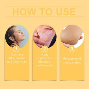 South Moon Bee Venom Psoriasis Caring Cream