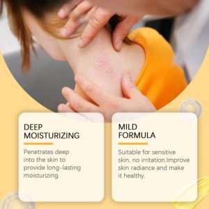 South Moon Bee Venom Psoriasis Caring Cream