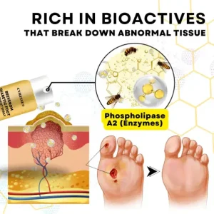 CVREOZ® Bee Venom Diabetic Foot Treatment Spray