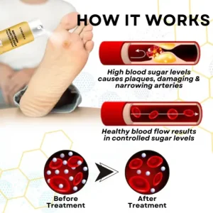 CVREOZ® Bee Venom Diabetic Foot Treatment Spray