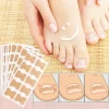 Toe Align Ingrown Nail Corrector Stickers
