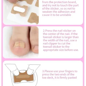 Toe Align Ingrown Nail Corrector Stickers
