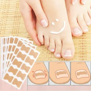 Toe Align Ingrown Nail Corrector Stickers