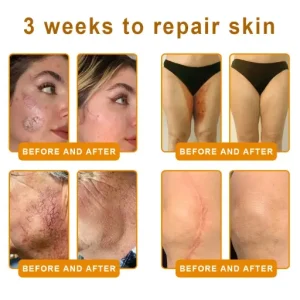 LOVILDS™ Bee Venom Skin Restoration Cream