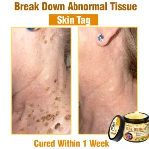 LOVILDS™ Bee Venom Skin Restoration Cream