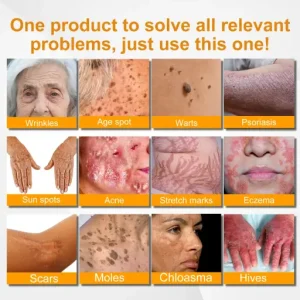 LOVILDS™ Bee Venom Skin Restoration Cream