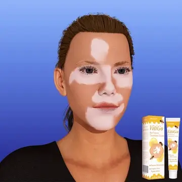 LOVILDS™ Bee Venom Vitiligo Treatment Cream