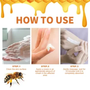 Cvreoz® Bee Venom Psoriasis Treatment Cream