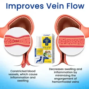 Cvreoz® Herbal Hemorrhoids Fast-Acting Treatment Spray